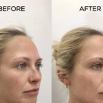 how to treat sun damaged skin