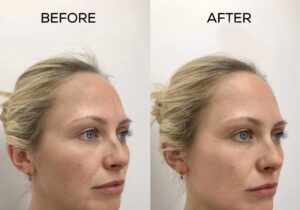 how to treat sun damaged skin